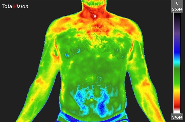 Thermal image of a torso.